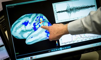 Dementia and incontinence